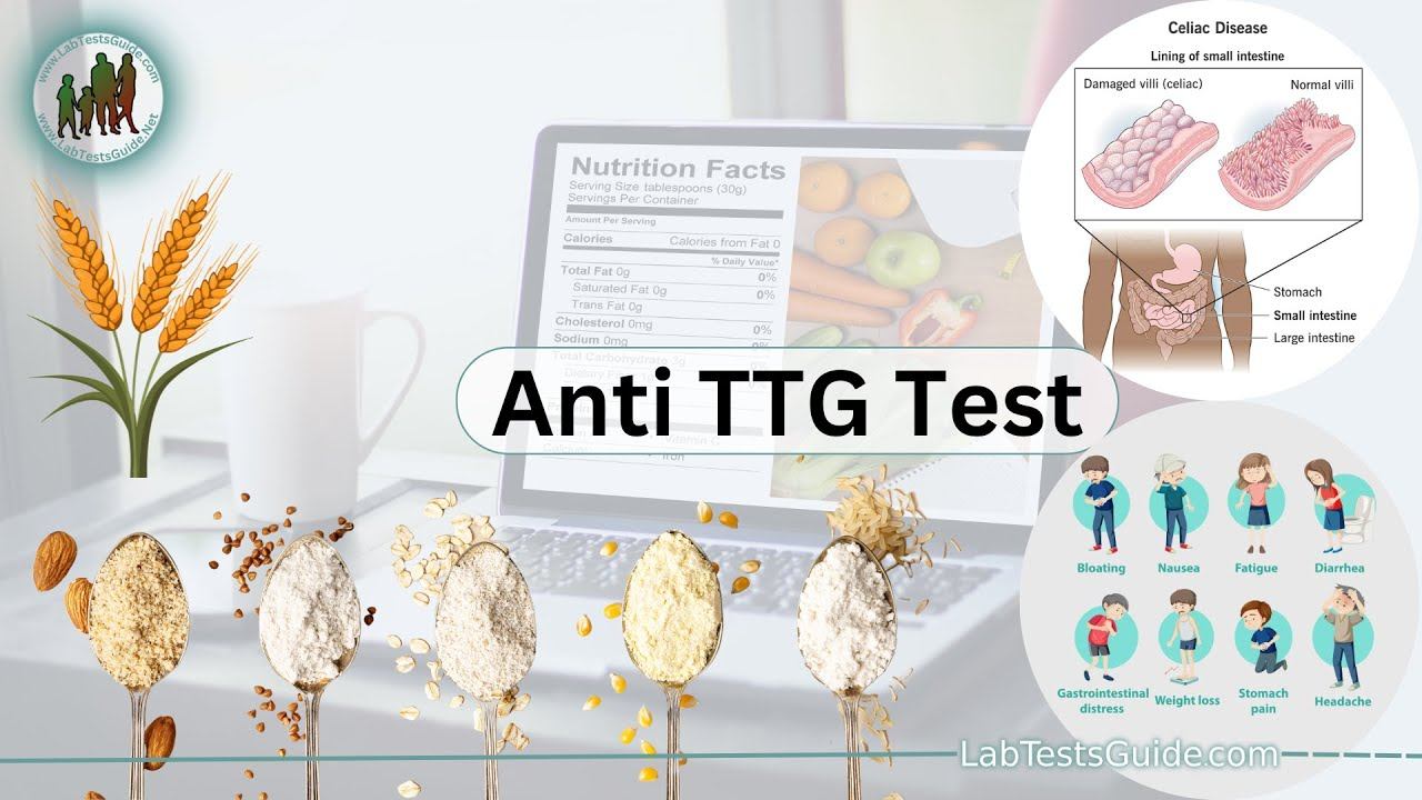 Anti TTG (Anti-tissue Transglutaminase) antibodies Test смотреть онлайн