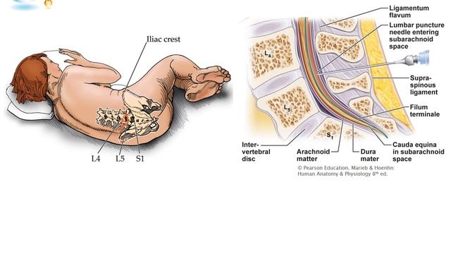 Deep Back and Vertebral Canal смотреть онлайн