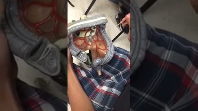 Fuckin colon (anatomy) смотреть онлайн