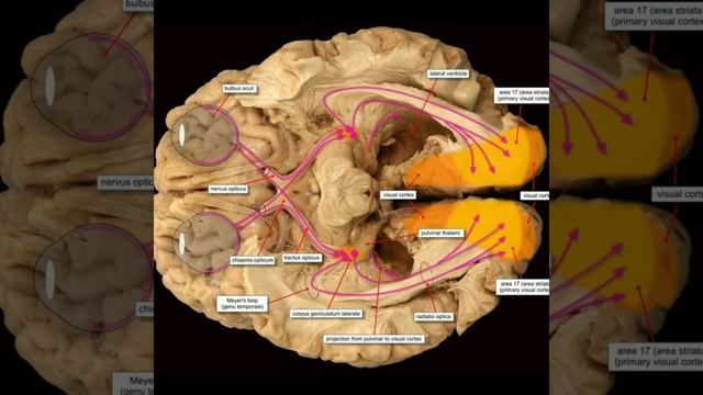 Optic Nerve Tract#doctor #shortsfeed #short #baby смотреть онлайн