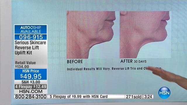 Reverse Lift Uplift Kit смотреть онлайн