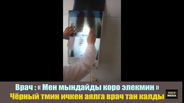 Чёрный тмин ичкен аялга врач ШОК | Дарыгер | пайдалуу кенеш смотреть онлайн