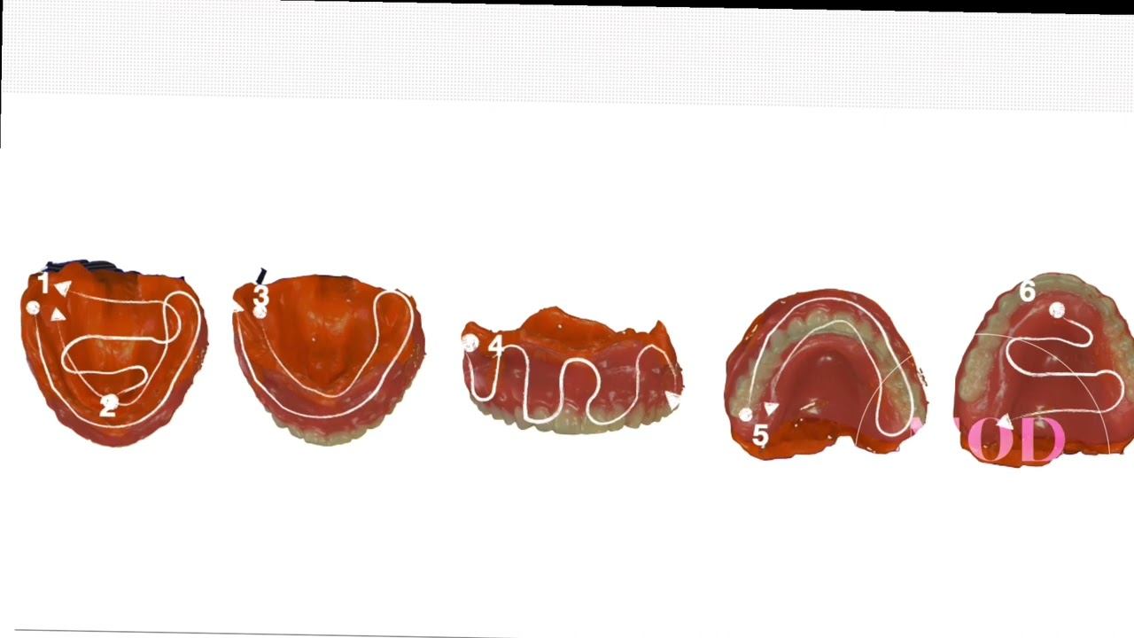 Two extremely important Top Tips on denture scanning in this video! Don’t miss it. смотреть онлайн
