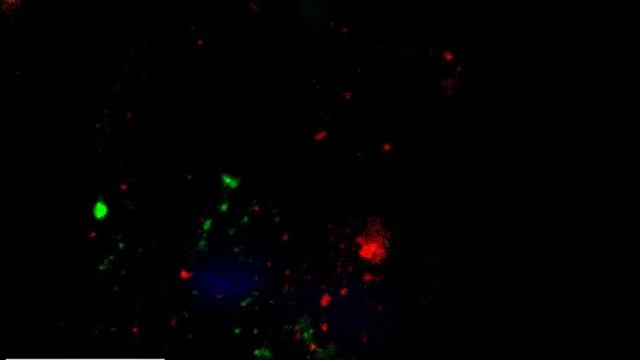 Paracellular Transmigration Of MDDCs.