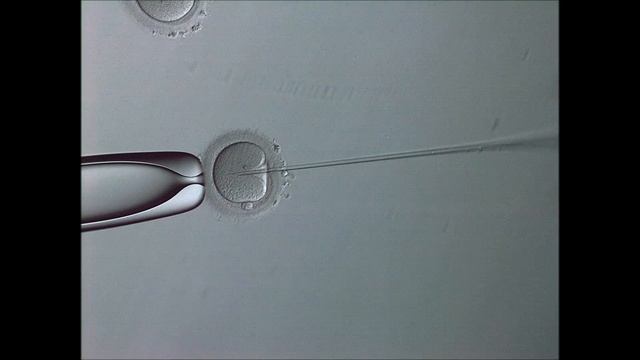 ИКСИ ЦРЗ смотреть онлайн