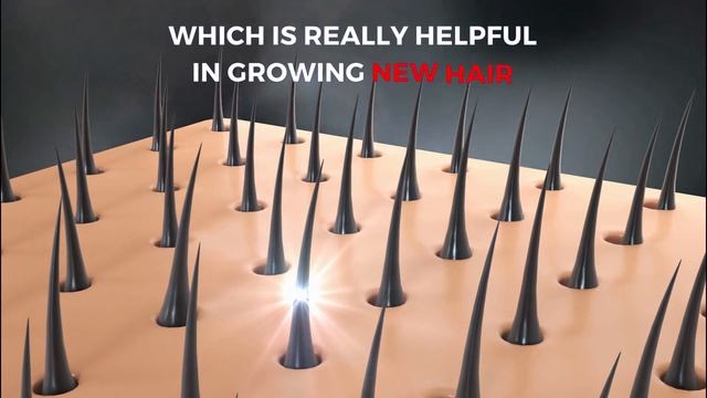 Serum Expert's Hair Growth Serum Is Very Effective|Redensyl|Anagain| Procapil|Natural Ingredients| смотреть онлайн