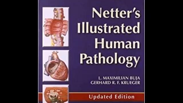 Netter's Illustrated Human Pathology Updated Edition: with Student Consult Access, 1e смотреть онлайн