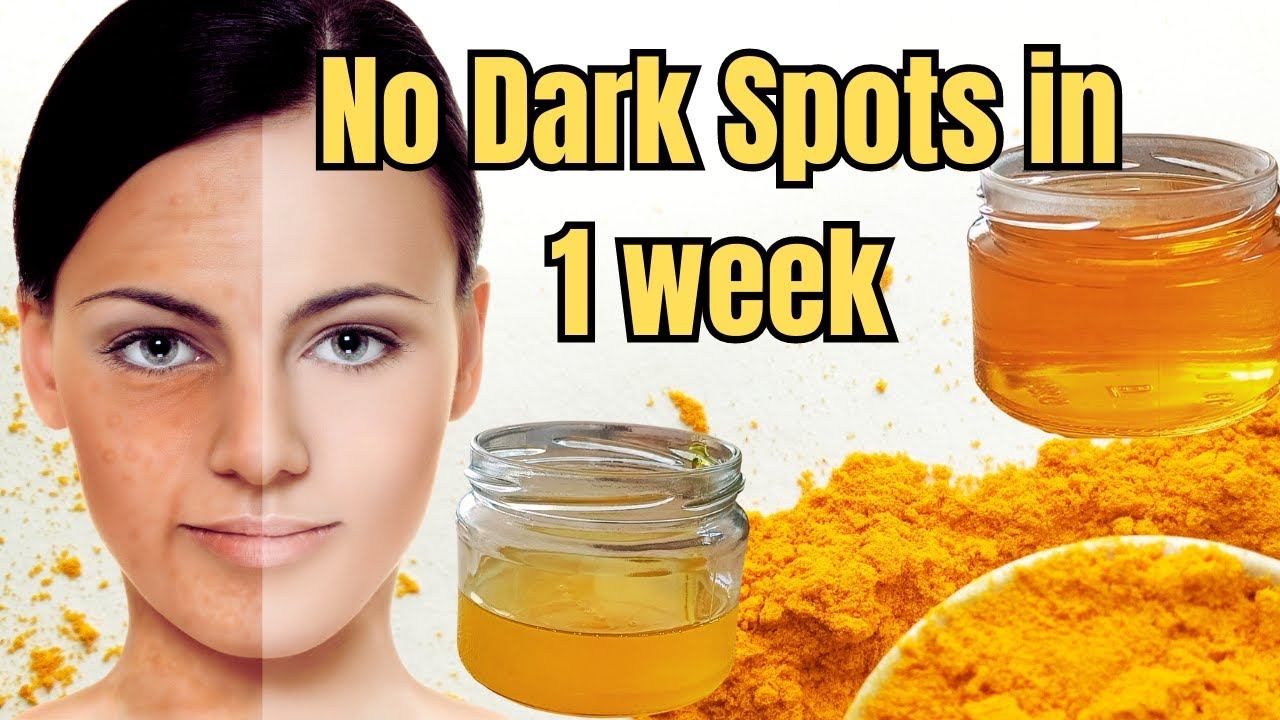 Get rid of Dark Spots in Just One Week [Turmeric DIY for Brighter & Lighter Skin] смотреть онлайн