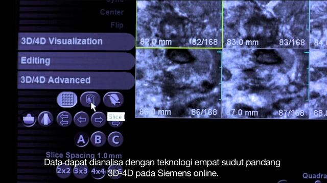 3D Sonomammogram смотреть онлайн