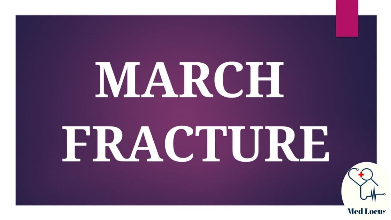 March Fracture (Anatomy) смотреть онлайн