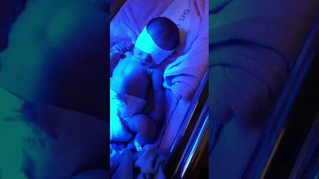 MICHAEL BABY HAS TOO HIGH BILIRUBIN LAMP TREATMENT ISRAEL DUE TO B BLOOD AGAINST O MOTHER BLOOD