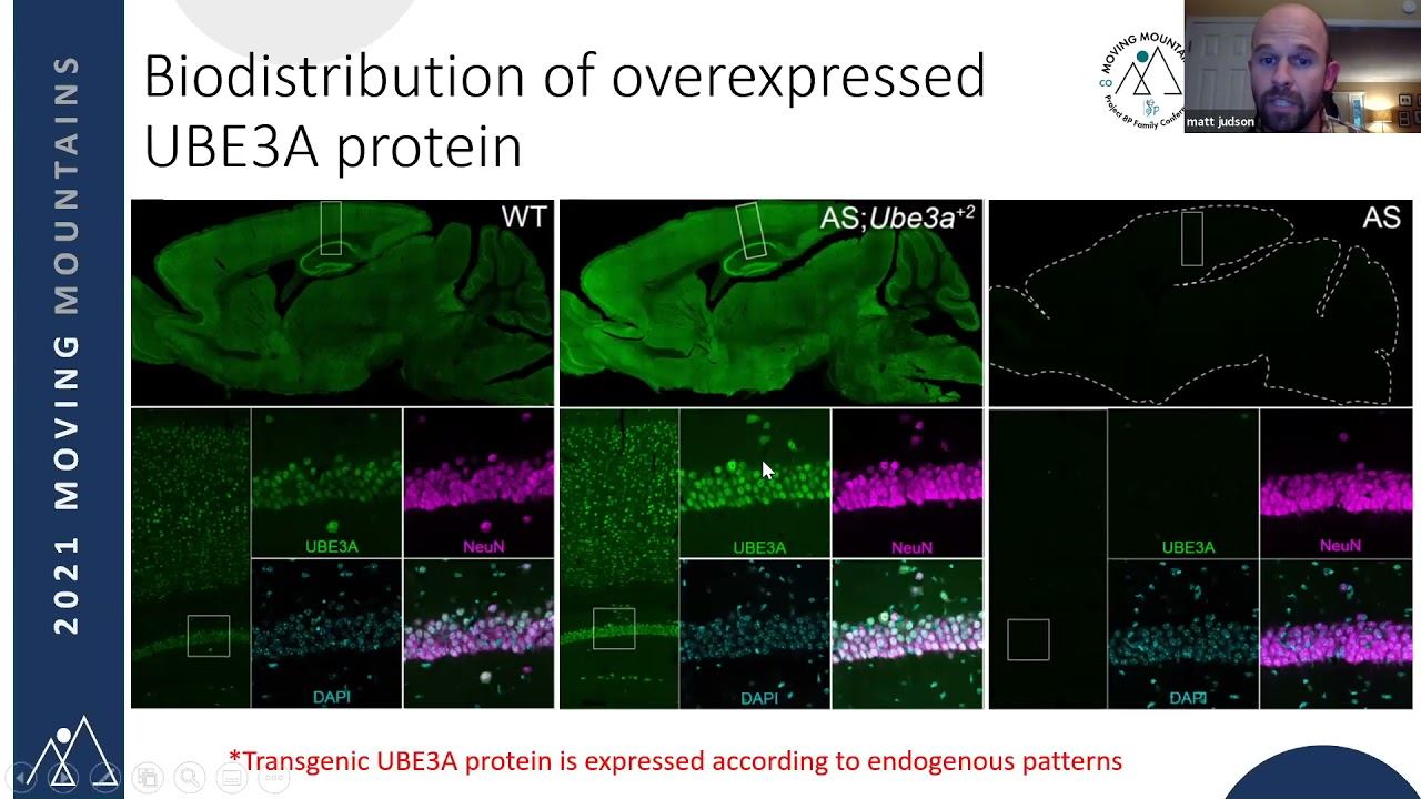 UBE3A Overexpression Model for Dup15q Syndrome смотреть онлайн
