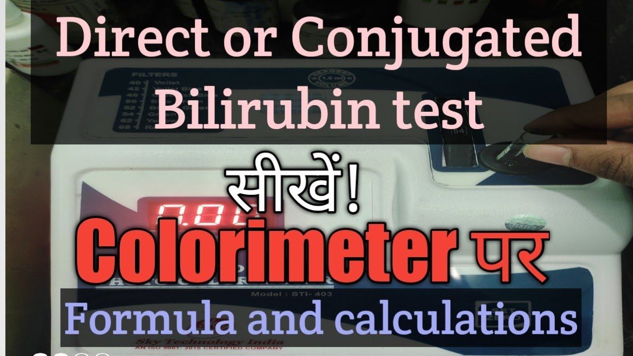Direct bilirubin test in colorimeter estimation of serum conjugated bilirubin смотреть онлайн