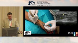 Сухинин Т.Ю.: болезнь Де-Кервена и синдром перекреста.