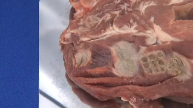 KENTAMED RF-B Demo Video смотреть онлайн