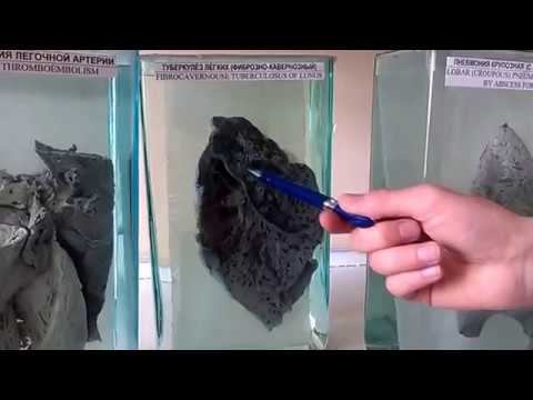 Патан Макропрепараты Ч1 смотреть онлайн
