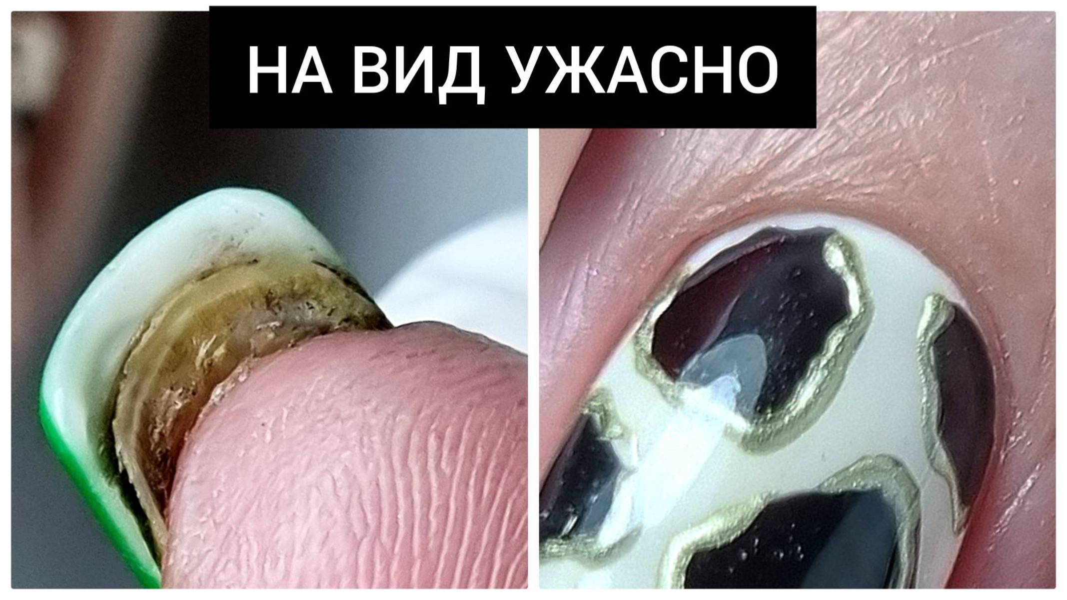 УЖАСНЫЙ ноготь ШИКАРНЫЙ результат