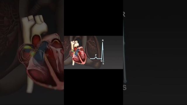 Funcionamento Cardíaco e Leitura ECG - Ondas P QRS e T смотреть онлайн