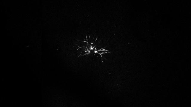 Smirnakis Lab - In Vivo Fluoro-ruby Labelled Cortical Neurons