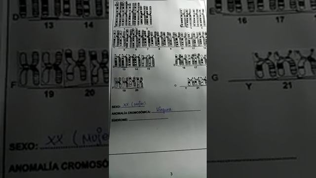 cariotipo humano grupo 7 parte 2 Valenzuela Meza смотреть онлайн