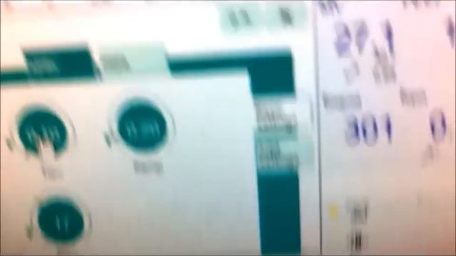 Introduction to the mode APRV.wmv Demonstrated on an Evita XL ventilator Simulator from Drager смотреть онлайн