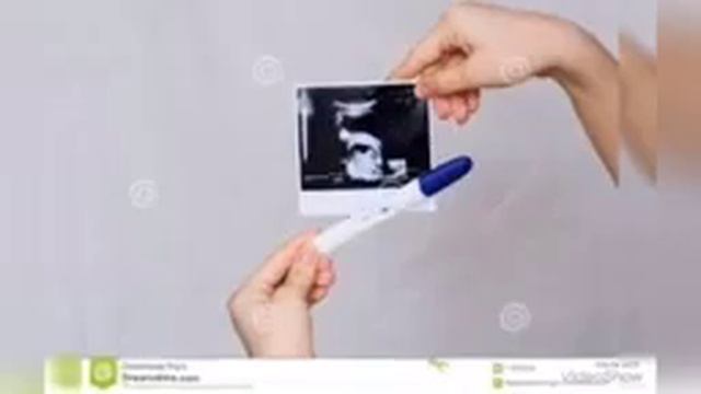 HOMILADORLIK PAYTIDA O'G'IL YOKI QIZLIGINI ANIQLASH 🤰🤱