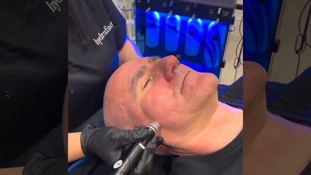 Unlocking Radiant Masculinity: The Benefits of Monthly HydraFacial Treatments for Men #menshealth смотреть онлайн