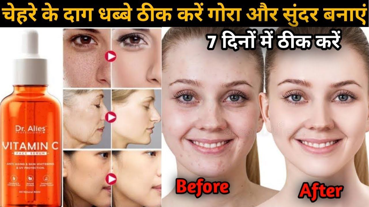 Dr. Alies Vitamin C Face Serum Review | Uses And Benefits | And How To Use | @RamVerma смотреть онлайн