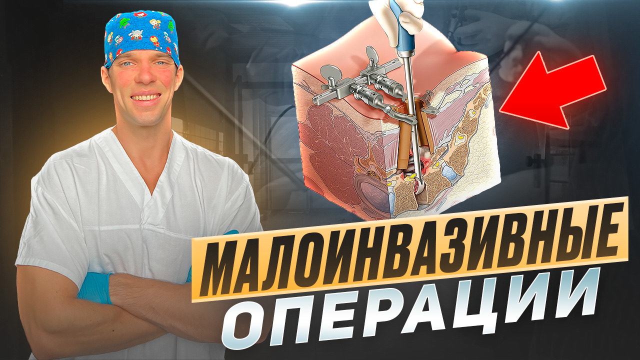 Хирургия - 3 вида: роботическая, эндоскопическая, эндоваскулярная смотреть онлайн