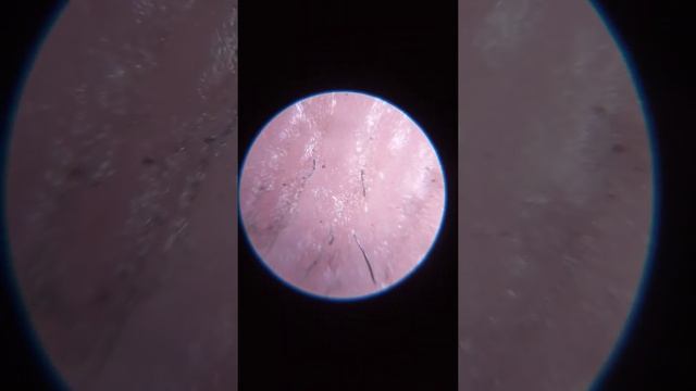 Палец под микроскопом смотреть онлайн