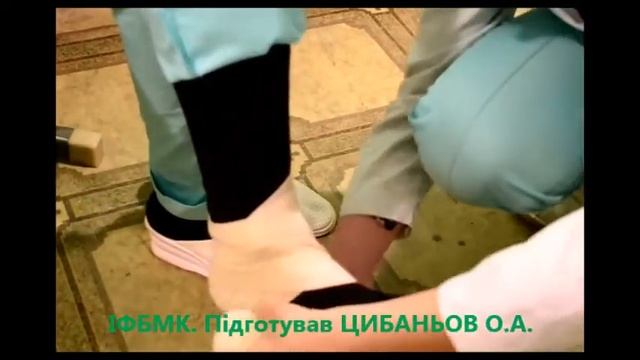 Пов’язка «Черепахоподібна розбіжна на гомілково-ступневий суглоб» смотреть онлайн