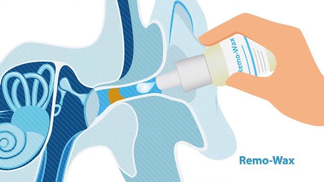 Removax RUS смотреть онлайн