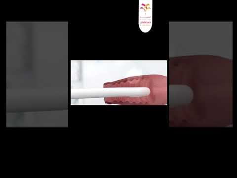 تجميل المنطقة الانثوية بالهايفو смотреть онлайн