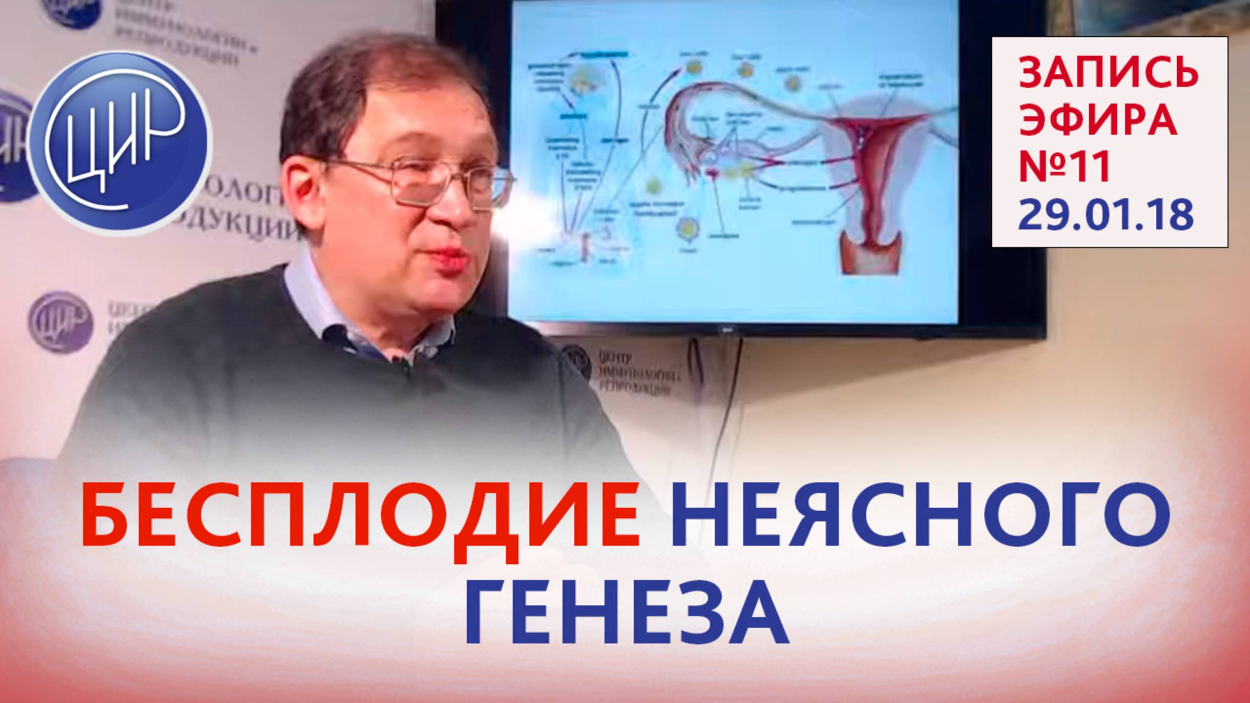 В ЦИРе и в мире. Бесплодие неясного генеза. Ответы на вопросы смотреть онлайн