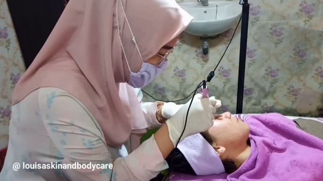 FACIAL DERMA GROWTH FACTOR | Dr.Renita Nuari Pulialza смотреть онлайн