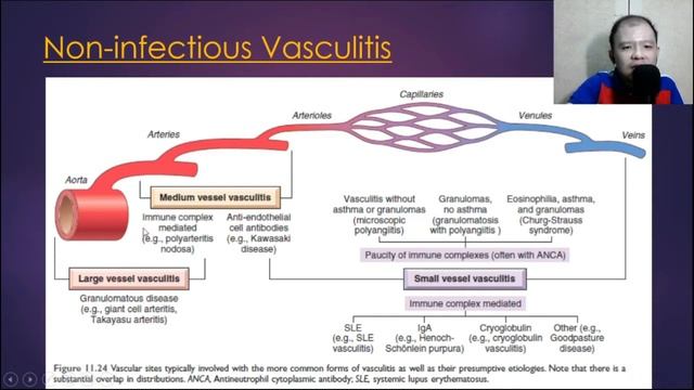 BLOOD VESSELS LECTURE by Dr. Lao смотреть онлайн