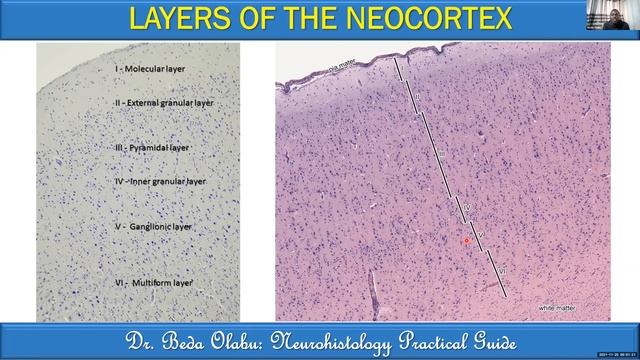 FUNCTIONS OF THE CEREBRAL CORTEX PART I - GENERAL STRUCTURE AND ROLE FRONTAL & PARIETAL CORTICES смотреть онлайн
