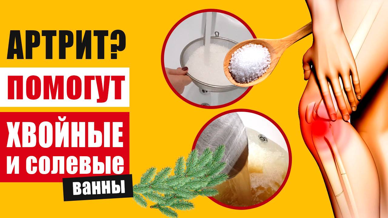 Хвойные и солевые ванны при артрите – восстановление суставов в домашних условиях смотреть онлайн