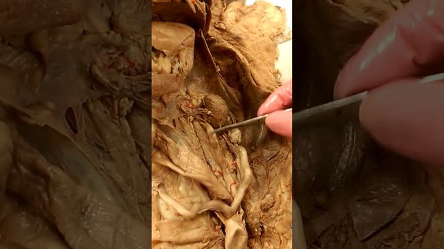 A&P 2 - Lab Practical 2 - Kidney Anatomy (2) смотреть онлайн