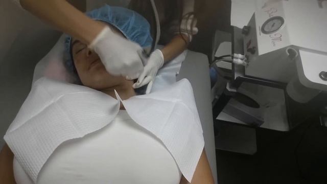 Micro derma bra sion 10-17-14 смотреть онлайн