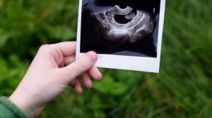 HOMILADORLIKNING 4-HAFTASI / ХОМИЛАДОРЛИКНИНГ 4-ХАФТАСИ