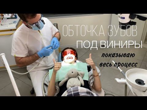 ОБРАТНОЙ ДОРОГИ НЕТ 🙈 СПИЛИЛИ ЗУБЫ 🥹 показываю весь процесс подготовки 🦷 к КЕРАМИЧЕСКИМ ВИНИРАМ смотреть онлайн