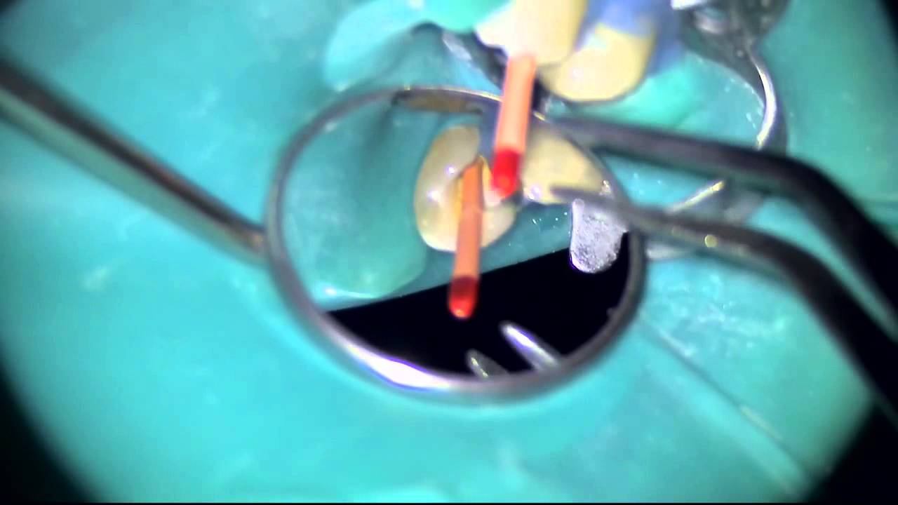 Omegastom смотреть онлайн