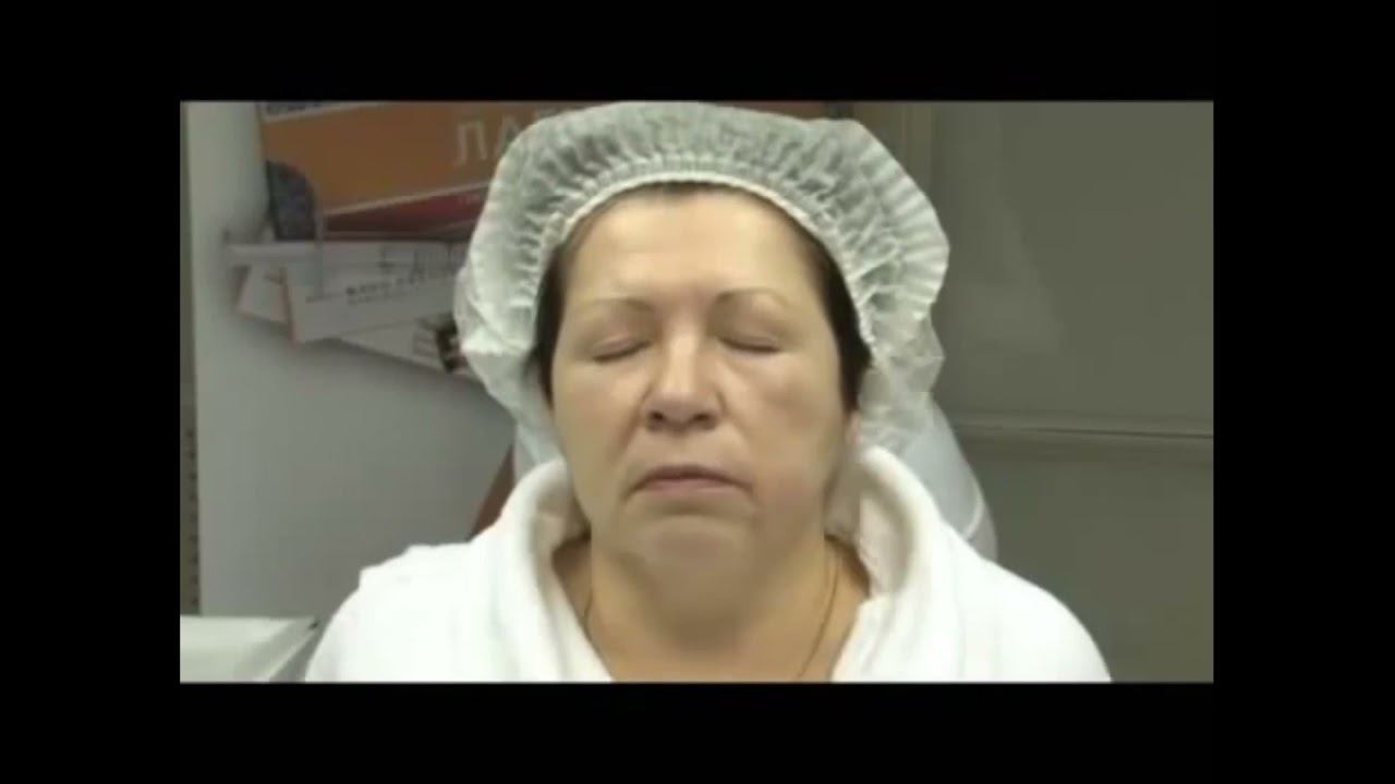 Тредлифтинг лица в сети клиник RHANA смотреть онлайн