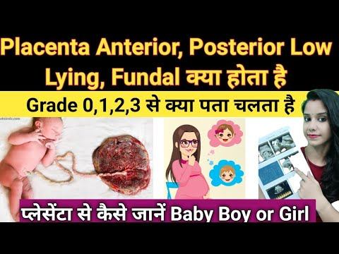 Placenta Position During Pregnancy in Hindi | Grade 1,2,3 Placenta Posterior means Baby Boy or Girl смотреть онлайн