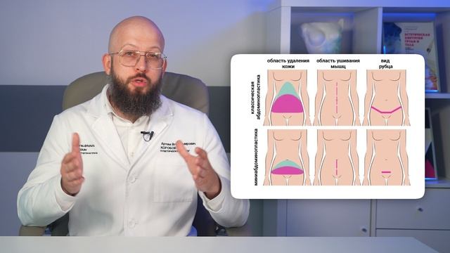 Идеальный живот без абдоминопластики. Возможно ли обойтись без нее? смотреть онлайн