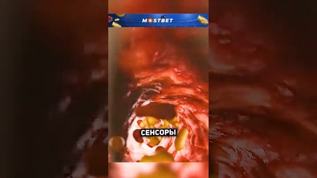 Что такое инсулиновый пластырь?😨