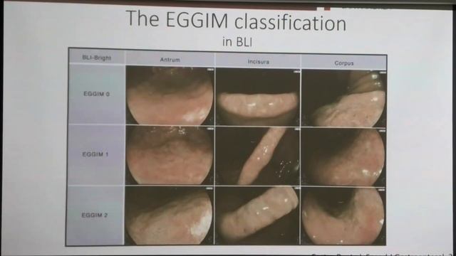 2024 06 22 Гастро06 Gianluca Esposito Endoscopic staging of gastritis the EGGIM system смотреть онлайн