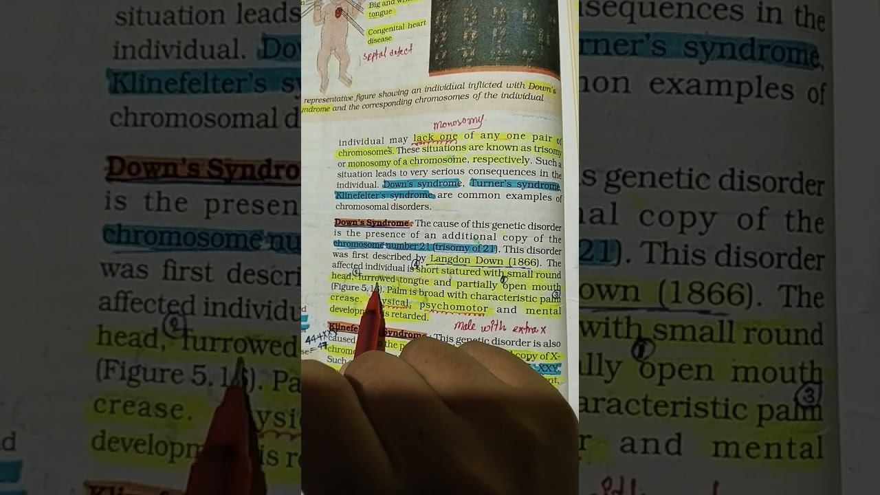 Down's Syndrome/ #neet2023 #neet #neetpyq #pyq #biology #important #neetaspirant #ncert смотреть онлайн