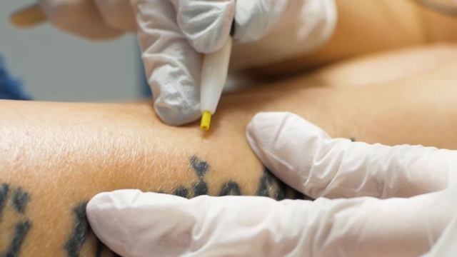 Видеосъемка Санкт - Петербург | Реклама процедуры в Spynx смотреть онлайн